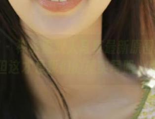微密圈 - 禅院熏双人写真最新原图有些尴尬，但这才是我们的真实写照，别错过